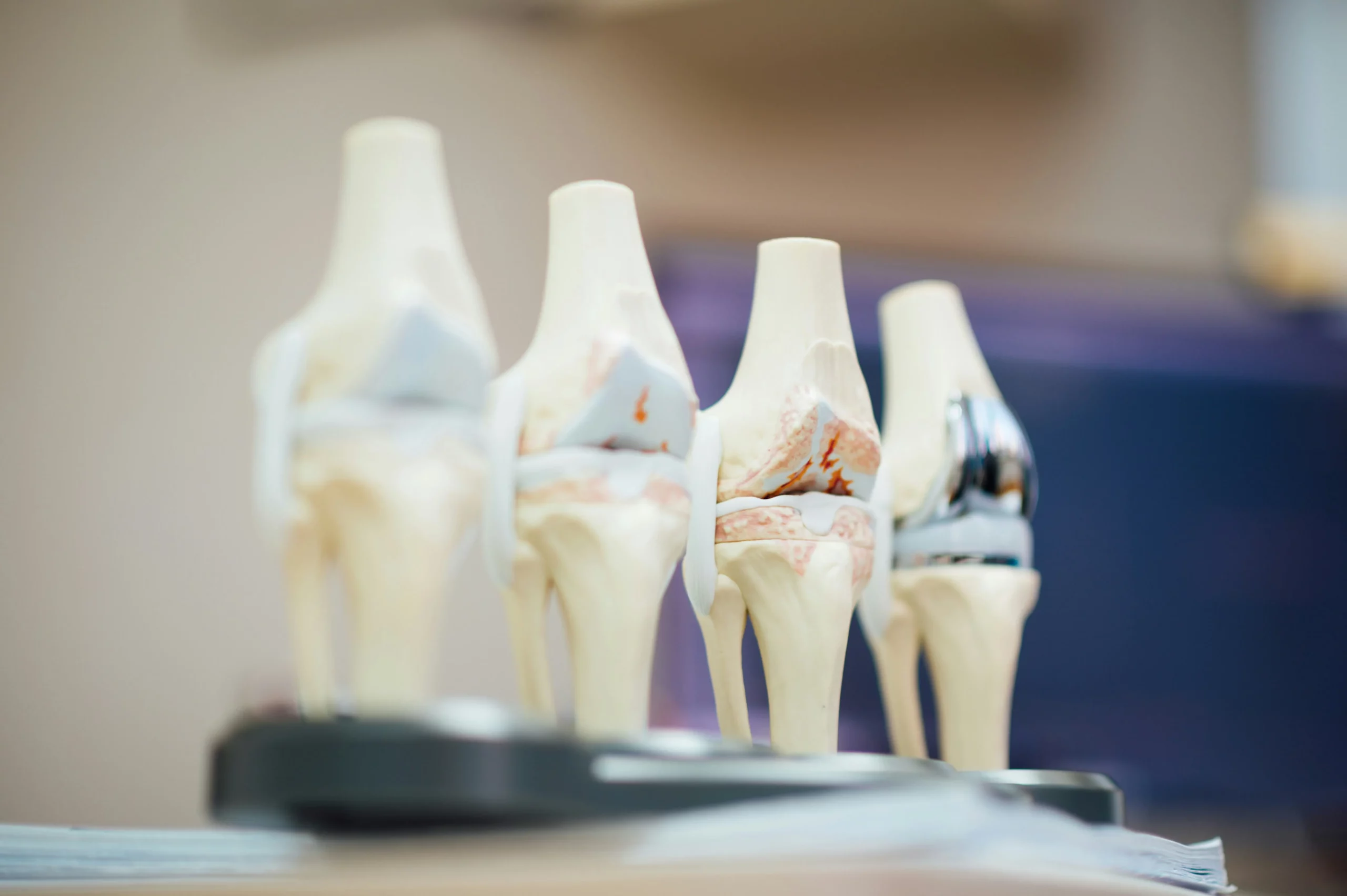 Articulations douloureuses : les causes physiologiques