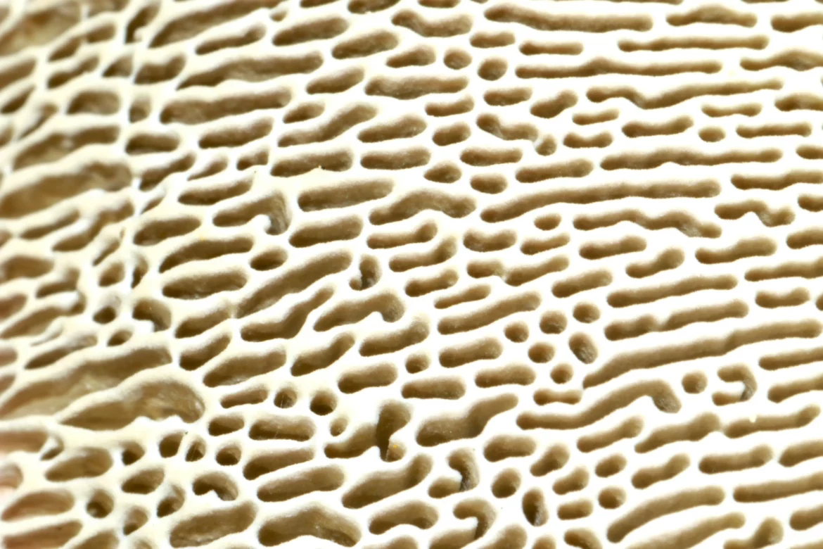 Ostéoporose